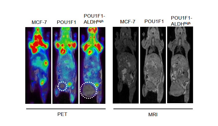 POU1F1 induces cancer stem cell-like traits in breast cancer cells by IL-6/JAK2/ STAT3 activation and enrichment of ALDH – Avila et al.