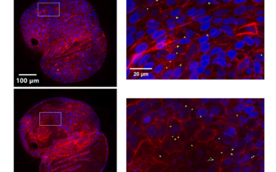 Small Particles, Big Problems: Polystyrene nanoparticles induce DNA damage, oxidative stress, migration, and mitogenic pathways predominantly in non-malignant lung cells – Ernhofer et al.