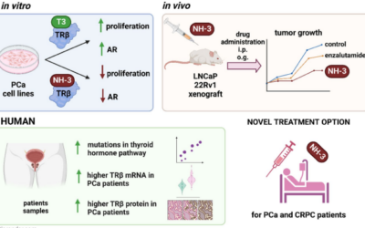 Thyroid hormone receptor beta signaling is a targetable driver of prostate cancer growth – Fesiuk et al.